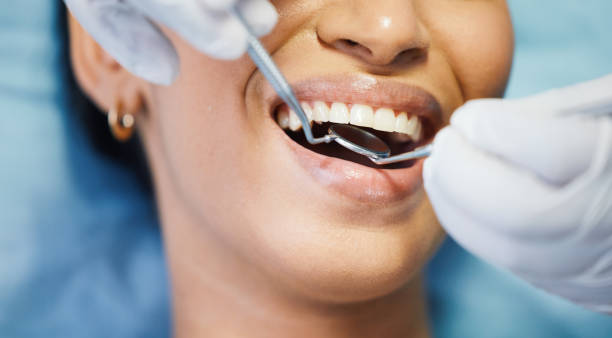 Best Walk-In Emergency Dental Services in Pekin, IL